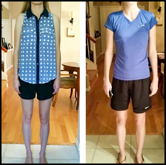 Before and After photo