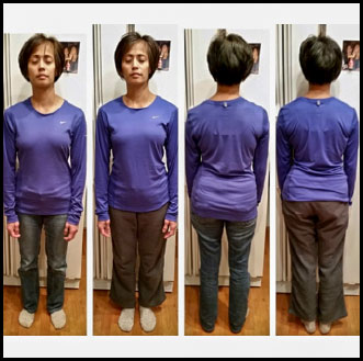 Before and After photo